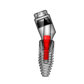 ANGLED CLICK ABUTMENT